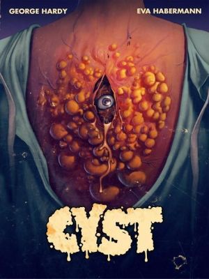 Affiche du document Cyst